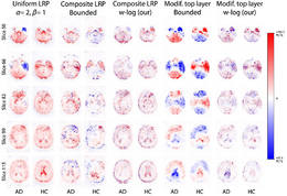 PR: FIIT STU student’s diploma thesis helps with Alzheimer's disease diagnosis using artificial intelligence