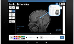 MedPix pomôže lekárom pri analýze medicínskych obrazových dát